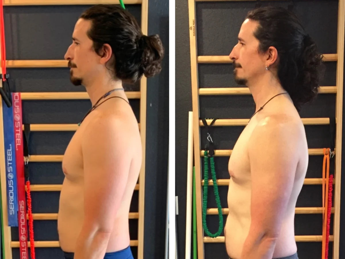 Smart Vibrating Posture Corrector